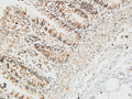 Anti-REG4 antibody (Internal) (STJ95405) – Figure 1 of 1