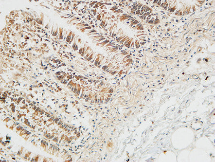 Anti-REG4 antibody (Internal) (STJ95405) – Figure 1 of 1