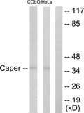 Anti-ATP6AP2 antibody (171-220 aa) (STJ95413) – Figure 1 of 1