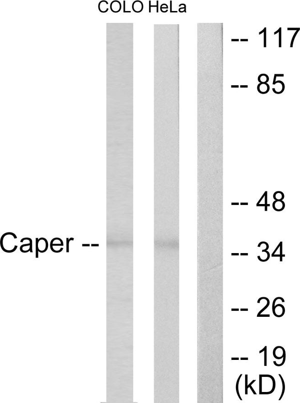 Anti-ATP6AP2 antibody (171-220 aa) (STJ95413) – Figure 1 of 1