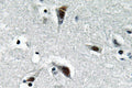 Anti-RFC3 antibody (178-227 aa) (STJ95426) – Figure 1 of 1