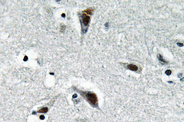 Anti-RFC3 antibody (178-227 aa) (STJ95426) – Figure 1 of 1