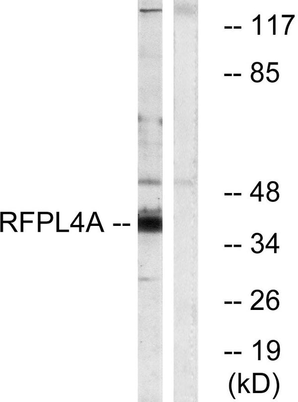 Anti-RFPL4A antibody (155-204 aa) (STJ95427) – Figure 1 of 1