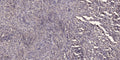 Anti-RTKN antibody (80-160 aa) (STJ95455) – Figure 1 of 1