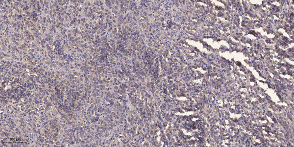 Anti-RTKN antibody (80-160 aa) (STJ95455) – Figure 1 of 1