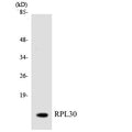 Anti-RPL30 antibody (66-115 aa) (STJ95471) – Figure 1 of 1
