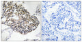 Anti-RPS25 antibody (76-125 aa) (STJ95497) – Figure 1 of 1