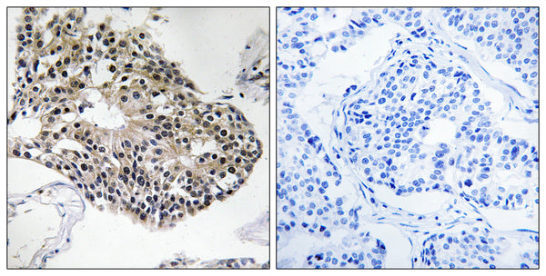 Anti-RPS25 antibody (76-125 aa) (STJ95497) – Figure 1 of 1