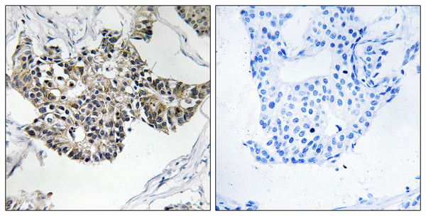 Anti-RSAD1 antibody (298-347 aa) (STJ95544) – Figure 1 of 1