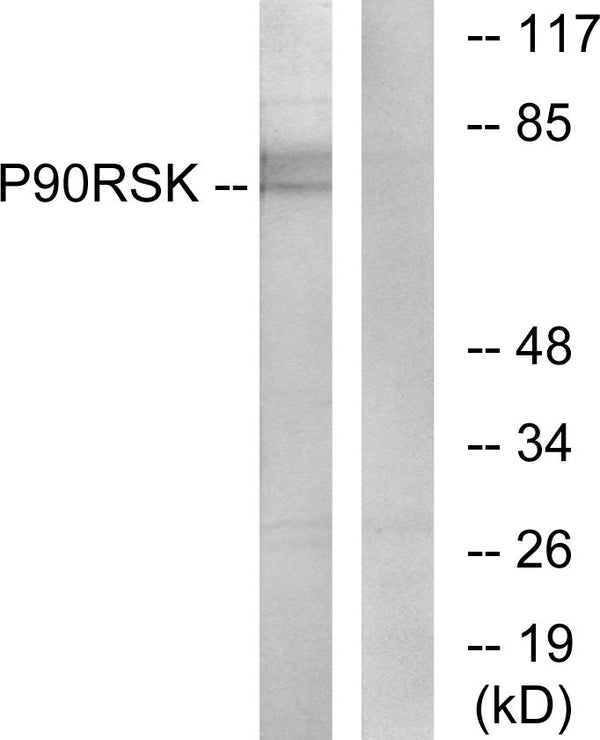 Anti-RPS6KA1 antibody (539-588 aa) (STJ95545) – Figure 1 of 1