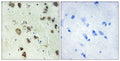 Anti-RPS6KA6 antibody (661-710 aa) (STJ95550) – Figure 1 of 1