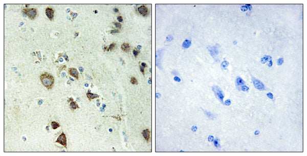 Anti-RPS6KA6 antibody (661-710 aa) (STJ95550) – Figure 1 of 1
