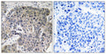 Anti-S100A3 antibody (26-75 aa) (STJ95565) – Figure 1 of 1