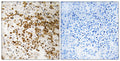 Anti-S100P antibody (26-75 aa) (STJ95568) – Figure 1 of 1