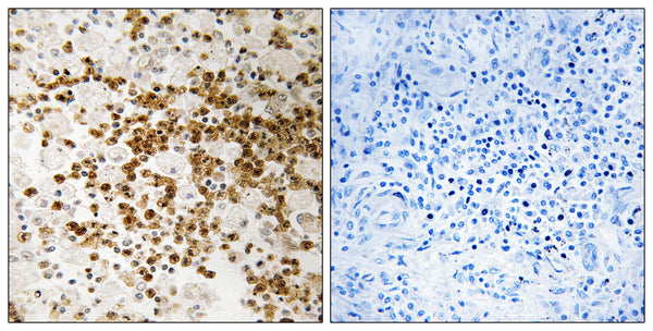 Anti-S100P antibody (26-75 aa) (STJ95568) – Figure 1 of 1