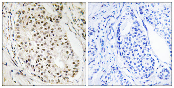 Anti-HNRNPUL2 antibody (601-650 aa) (STJ95573) – Figure 1 of 1