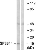 Anti-SF3B6 antibody (76-125 aa) (STJ95575) – Figure 1 of 1