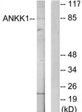 Anti-ANKK1 antibody (321-370 aa) (STJ95637) – Figure 1 of 1
