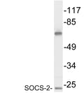 Anti-SOCS2 antibody (18-67 aa) (STJ95728) – Figure 1 of 1