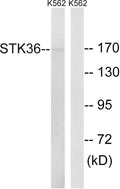 Anti-STK36 antibody (387-436 aa) (STJ95827) – Figure 1 of 1