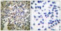 Anti-Synaptotagmin antibody (276-325 aa) (STJ95849) – Figure 1 of 1