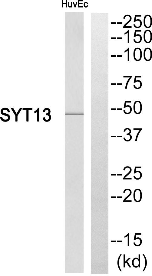 Anti-SYT13 antibody (321-370 aa) (STJ95853) – Figure 1 of 1