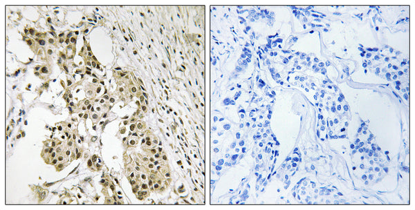 Anti-TAGAP antibody (191-240 aa) (STJ95899) – Figure 1 of 1
