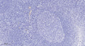 Anti-TBK1 antibody (138-187 aa) (STJ95926) – Figure 1 of 1