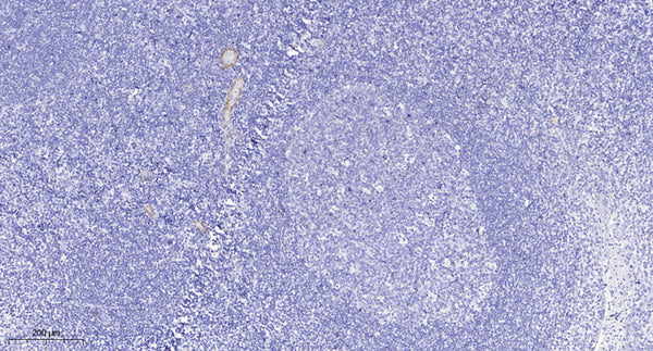 Anti-TBK1 antibody (138-187 aa) (STJ95926) – Figure 1 of 1