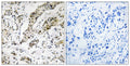 Anti-TCEAL3/5/6 antibody (141-190 aa) (STJ95939) – Figure 1 of 1