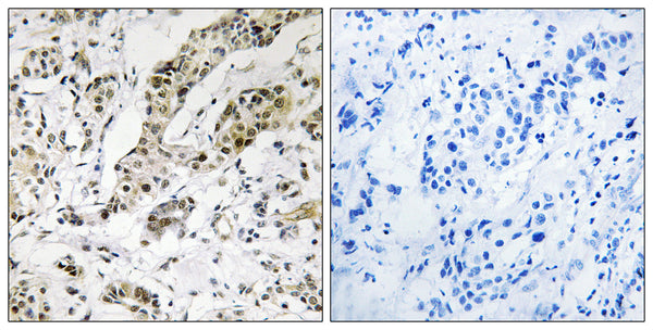 Anti-TCEAL3/5/6 antibody (141-190 aa) (STJ95939) – Figure 1 of 1