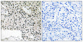 Anti-TCEAL4 antibody (166-215 aa) (STJ95940) – Figure 1 of 1
