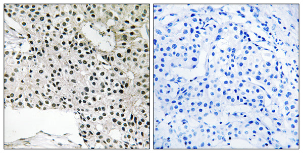 Anti-TCEAL4 antibody (166-215 aa) (STJ95940) – Figure 1 of 1