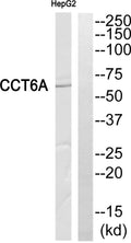 Anti-CCT6A antibody (171-220 aa) (STJ95950) – Figure 1 of 1
