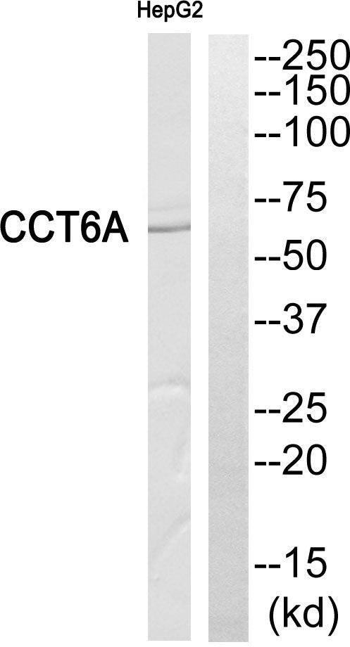 Anti-CCT6A antibody (171-220 aa) (STJ95950) – Figure 1 of 1