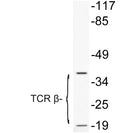 Anti-TRBC1 antibody (66-115 aa) (STJ95953) – Figure 1 of 1