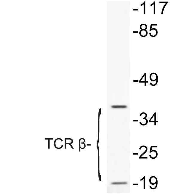Anti-TRBC1 antibody (66-115 aa) (STJ95953) – Figure 1 of 1
