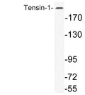 Anti-TNS1 antibody (1273-1322 aa) (STJ95968) – Figure 1 of 1