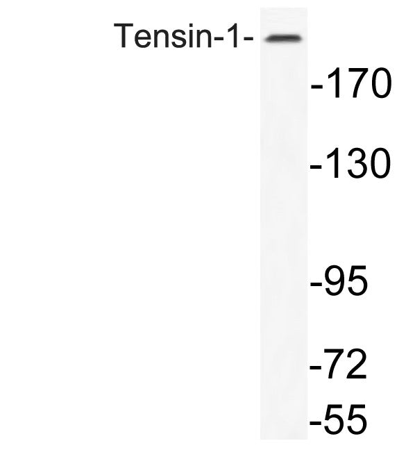Anti-TNS1 antibody (1273-1322 aa) (STJ95968) – Figure 1 of 1