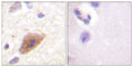 Anti-TH antibody (5-54 aa) (STJ96004) – Figure 1 of 1