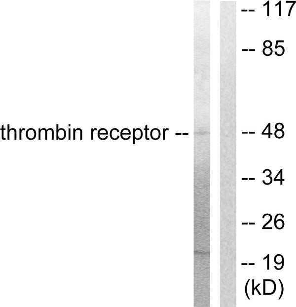 Anti-F2R antibody (10-59 aa) (STJ96010) – Figure 1 of 1