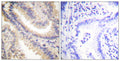 Anti-TIMP4 antibody (175-224 aa) (STJ96026) – Figure 1 of 1
