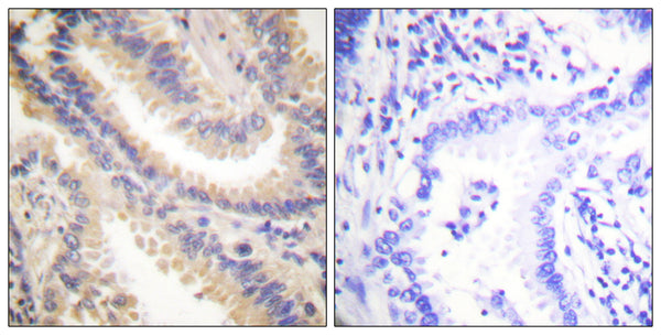 Anti-TIMP4 antibody (175-224 aa) (STJ96026) – Figure 1 of 1