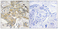 Anti-TM4SF1 antibody (1-50 aa) (STJ96040) – Figure 1 of 1