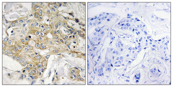 Anti-TM4SF1 antibody (1-50 aa) (STJ96040) – Figure 1 of 1