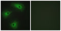 Anti-ANO1 antibody (921-970 aa) (STJ96044) – Figure 1 of 1
