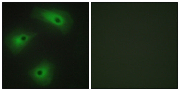Anti-ANO1 antibody (921-970 aa) (STJ96044) – Figure 1 of 1