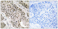 Anti-TNNI3K antibody (301-350 aa) (STJ96057) – Figure 1 of 1