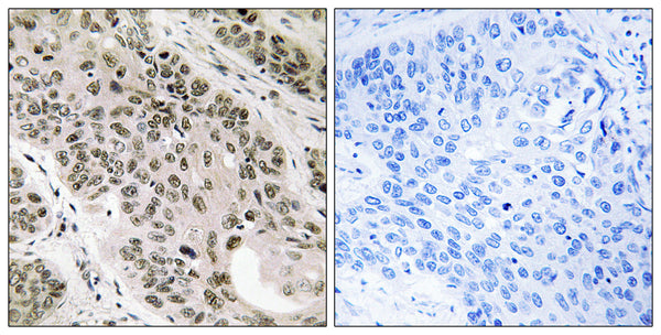 Anti-TNNI3K antibody (301-350 aa) (STJ96057) – Figure 1 of 1