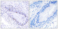 Anti-TEP1 antibody (171-220 aa) (STJ96069) – Figure 1 of 1